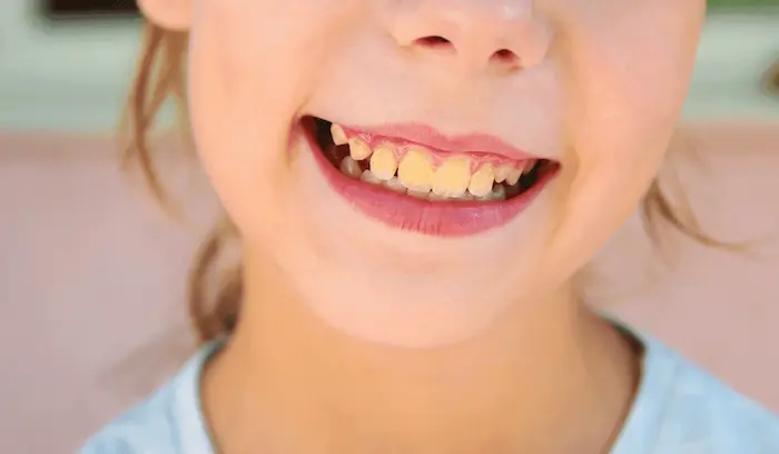 دختری که دندان های زرد دارد 41257952